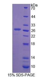 Figure 1. SDS-PAGE