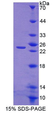 Figure 1. SDS-PAGE