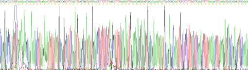 Human Interferon Gamma (IFNg), Active Protein