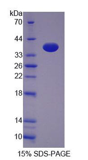 Figure 1. SDS-PAGE