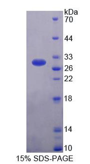 Figure 1. SDS-PAGE