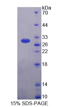 Figure 1. SDS-PAGE