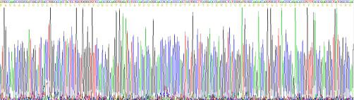 Recombinant Human Heat Shock 70kDa Protein 1A (HSPA1A)
