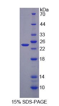 Figure 1. SDS-PAGE