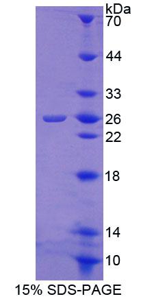 Figure 1. SDS-PAGE