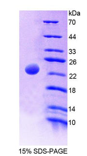 Figure 1. SDS-PAGE