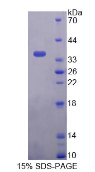 Figure 1. SDS-PAGE