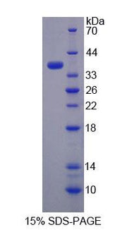 Figure 1. SDS-PAGE