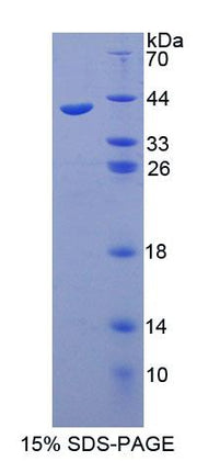 Figure 1. SDS-PAGE