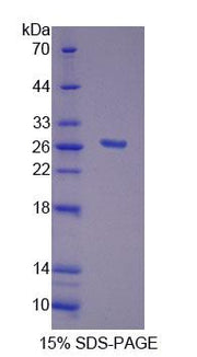 Figure 1. SDS-PAGE