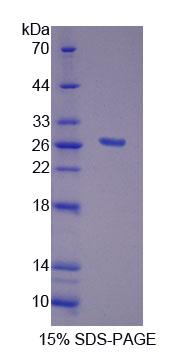 Figure 1. SDS-PAGE