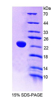 Figure 1. SDS-PAGE