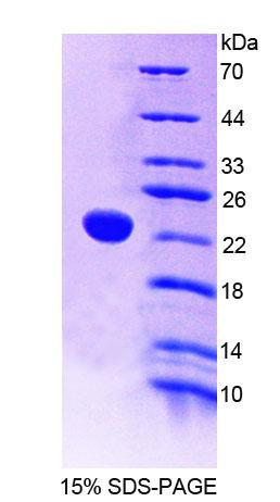 Figure 1. SDS-PAGE