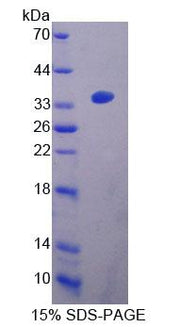 Figure 1. SDS-PAGE