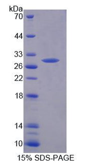 Figure 1. SDS-PAGE