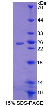 Figure 1. SDS-PAGE
