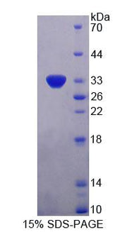 Figure 1. SDS-PAGE