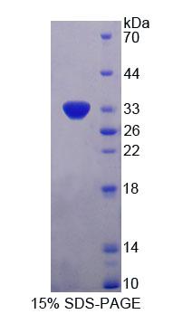 Figure 1. SDS-PAGE