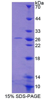 Figure 1. SDS-PAGE