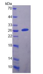 Figure 2. SDS-PAGE