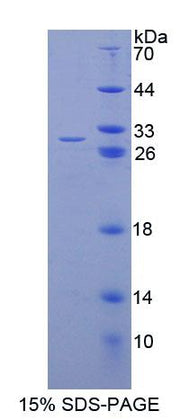 Figure 1. SDS-PAGE