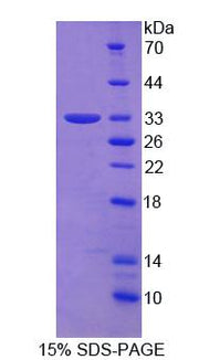 Figure 1. SDS-PAGE