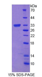 Figure 1. SDS-PAGE