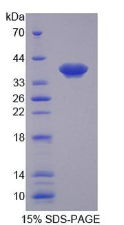 Figure 1. SDS-PAGE