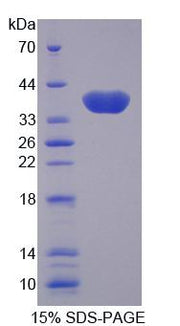 Figure 1. SDS-PAGE