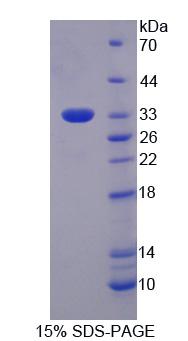 Figure 1. SDS-PAGE