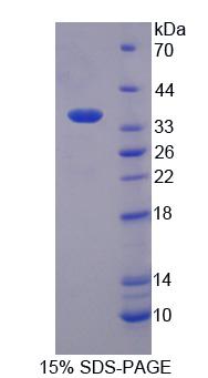 Figure 1. SDS-PAGE