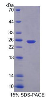 Figure 1. SDS-PAGE