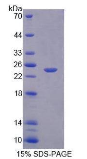 Figure 1. SDS-PAGE