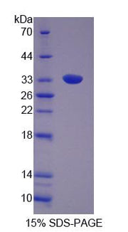 Figure 1. SDS-PAGE