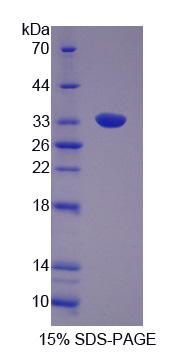 Figure 1. SDS-PAGE