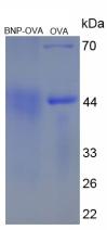 OVA Conjugated Human Brain Natriuretic Peptide (BNP)