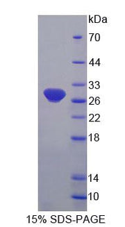 Figure 1. SDS-PAGE