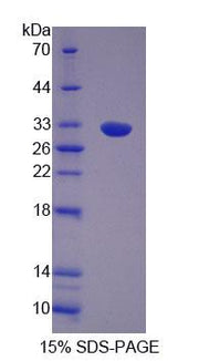 Figure 1. SDS-PAGE