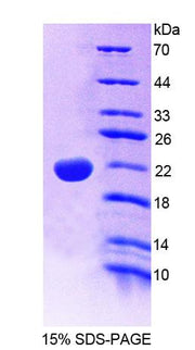 Figure 1. SDS-PAGE