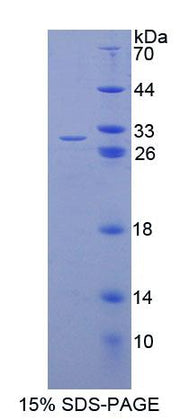 Figure 1. SDS-PAGE