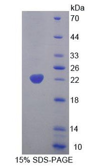 Figure 1. SDS-PAGE