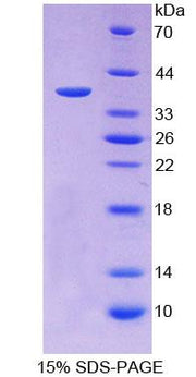 Figure 1. SDS-PAGE