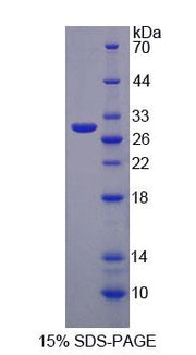Figure 1. SDS-PAGE