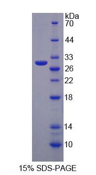 Figure 1. SDS-PAGE