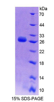 Figure 1. SDS-PAGE