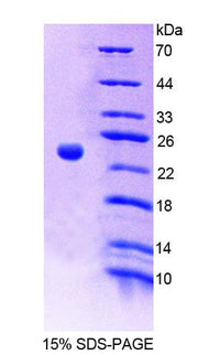 Figure 1. SDS-PAGE