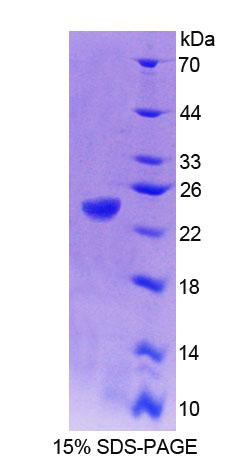 Figure 1. SDS-PAGE