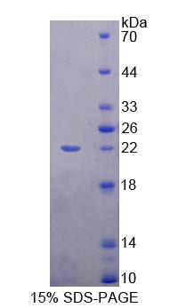 Figure 1. SDS-PAGE