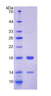 Figure 1. SDS-PAGE