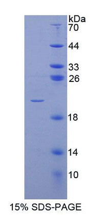 Figure 1. SDS-PAGE